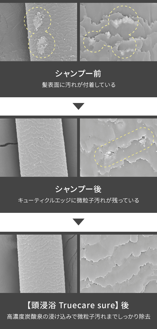 シャンプー前:髪表面に汚れが付着している シャンプー後:キューティクルエッジに微粒子汚れが残っている 【頭浸浴 Truecare sure】後:高濃度炭酸泉の浸け込みで微粒子汚れまでしっかり除去