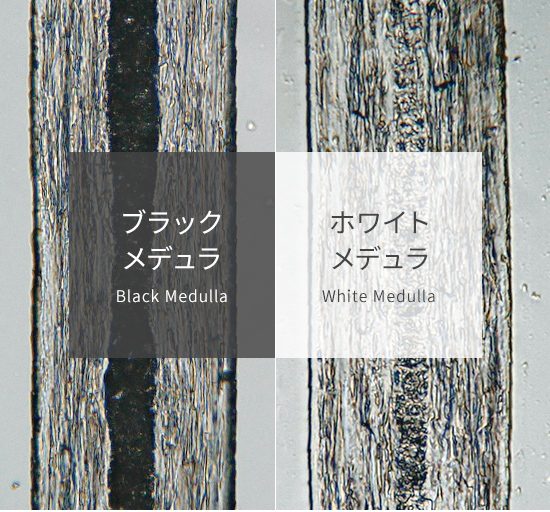 ブラックメデュラ ホワイトメデュラ